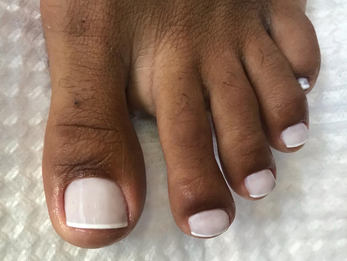 Transformação que amamos 🫣

.
.

#pés #pedicure #cutilagemperfeita #cutilagem #cutilagemfunda #cutilagemfundinha #semdor #riodejaneiro #riodasostras #regiaodoslagos