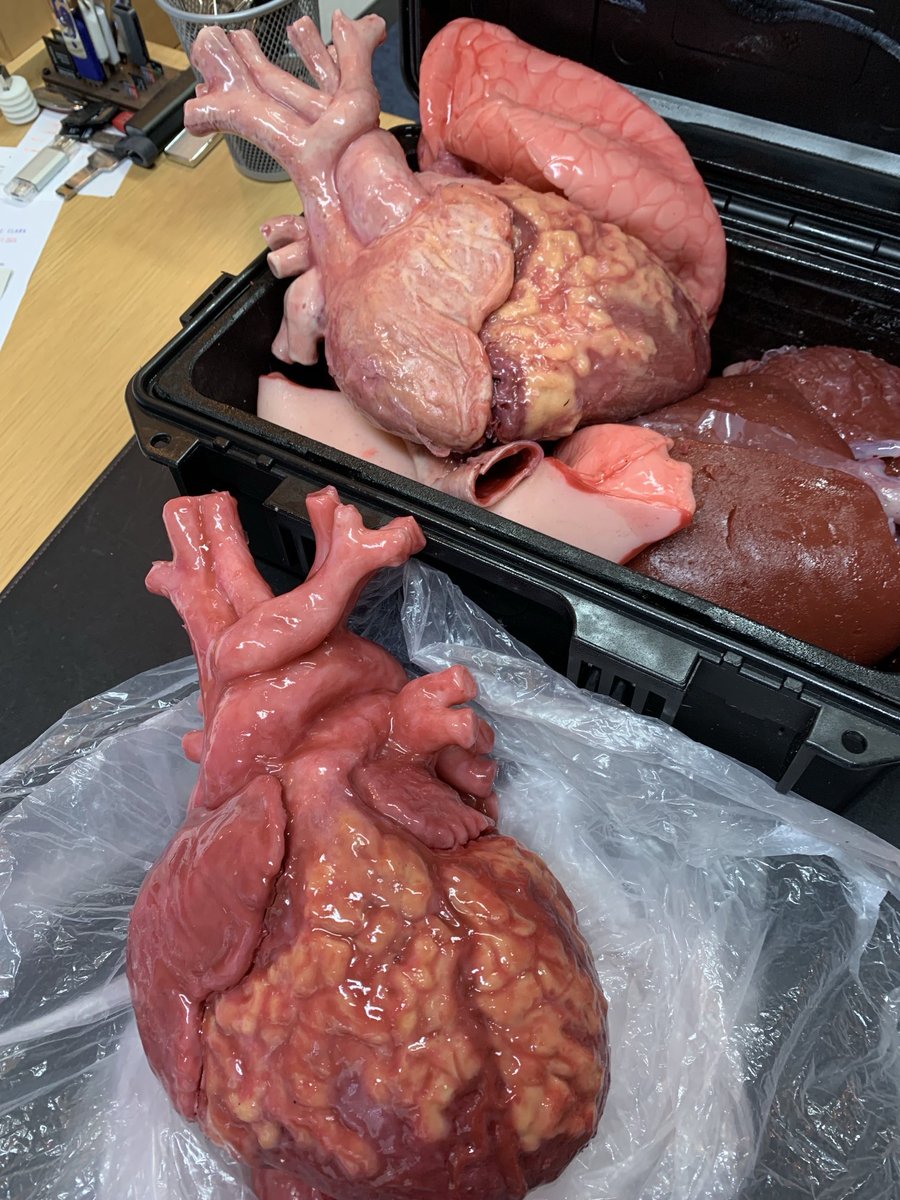 Another picture of our latest heart transplant simulator prototype for surgeons in training. You can cut it, suture it, repair it with silicone gel and use it over and over until you have the operative technique perfected before going anywhere near a patient.