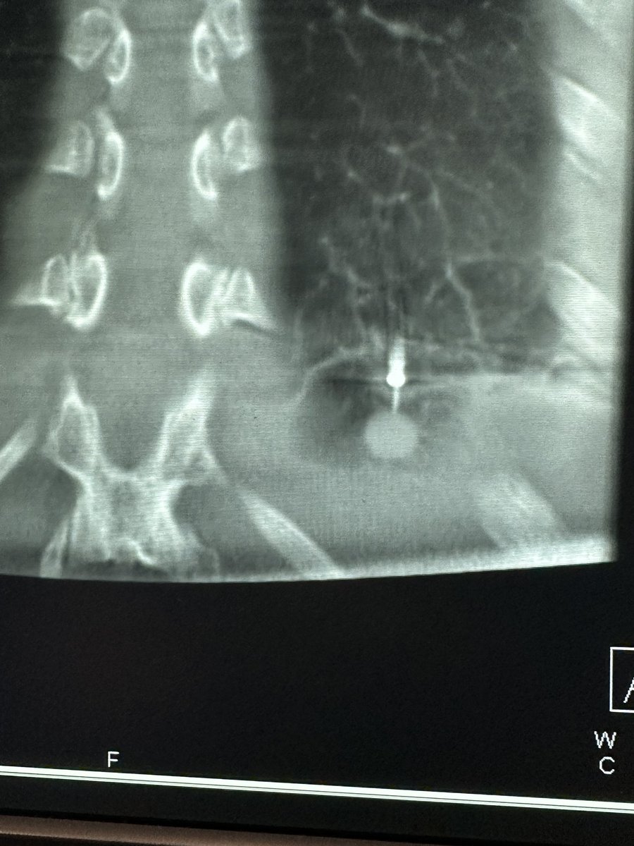 Bhadra & Condra CBCT Bronchoscopy tweet media