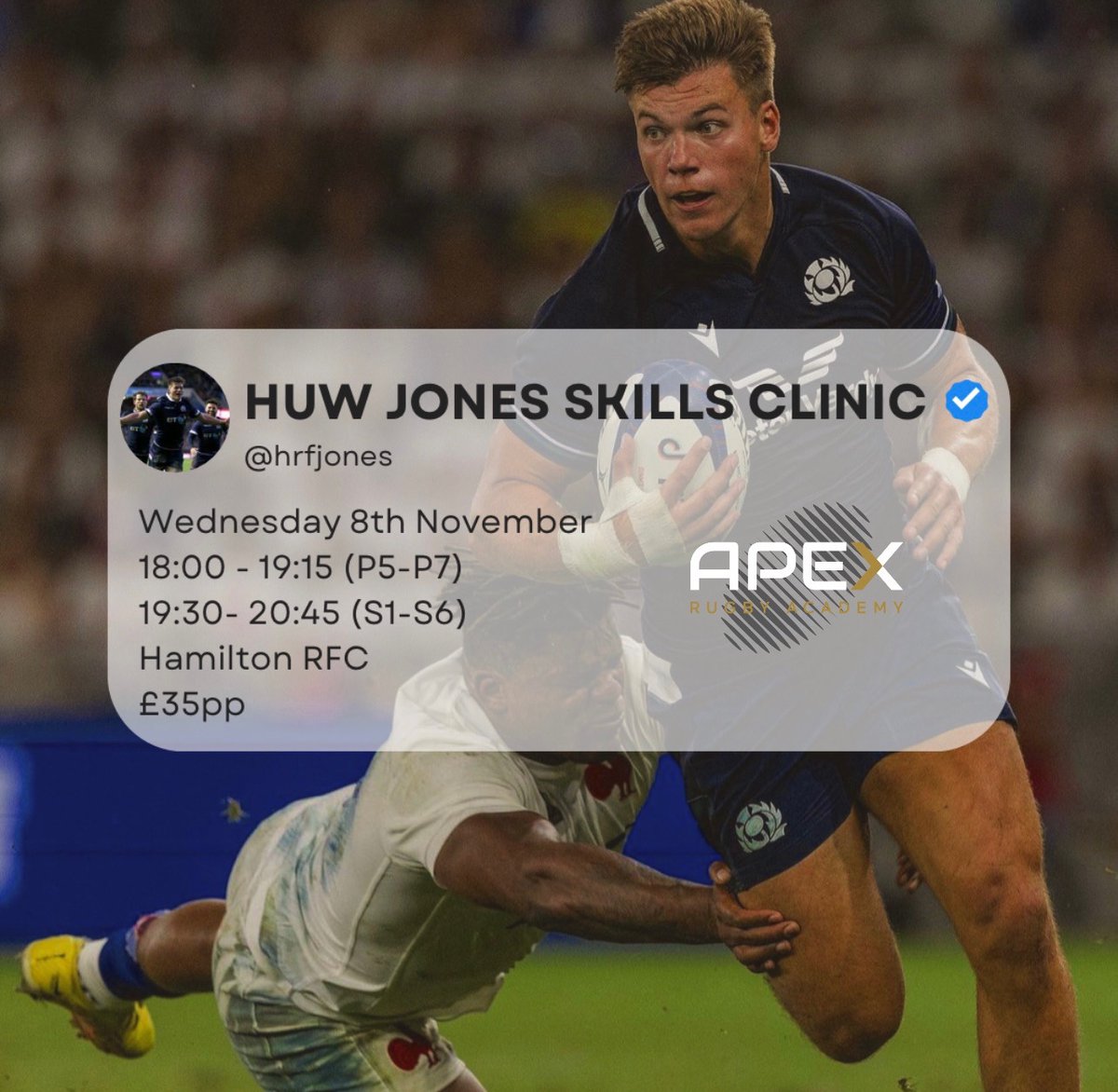 Apex Rugby Academy (@_apexrugby) on Twitter photo ๐ด๓ ง๓ ข๓ ณ๓ ฃ๓ ด๓ ฟ ๐๐จ๐ช ๐๐ข๐ก๐๐ฆ ๐ฆ๐๐๐๐๐ฆ ๐๐๐๐ก๐๐ ๐ด๓ ง๓ ข๓ ณ๓ ฃ๓ ด๓ ฟ
๐ช๐ฒ๐ฑ๐ป๐ฒ๐๐ฑ๐ฎ๐ ๐ด๐๐ต ๐ก๐ผ๐๐ฒ๐บ๐ฏ๐ฒ๐ฟ
๐ญ๐ด:๐ฌ๐ฌ - ๐ญ๐ต:๐ญ๐ฑ (๐ฃ๐ฑ-๐ฃ๐ณ)
๐ญ๐ต:๐ฏ๐ฌ - ๐ฎ๐ฌ:๐ฐ๐ฑ (๐ฆ๐ญ-๐ฆ๐ฒ)
๐๐ฎ๐บ๐ถ๐น๐๐ผ๐ป ๐ฅ๐๐
ยฃ๐ฏ๐ฑ๐ฝ๐ฝ
๐๐ข๐ข๐๐๐ก๐๐ฆ ๐ข๐ฃ๐๐ก ๐ง๐ข๐ ๐ข๐ฅ๐ฅ๐ข๐ช ๐ ๐ข๐ฅ๐ก๐๐ก๐
@HRFJones ๐ด๓ ง๓ ข๓ ณ๓ ฃ๓ ด๓ ฟ ๐๐จ๐ช ๐๐ข๐ก๐๐ฆ ๐ฆ๐๐๐๐๐ฆ ๐๐๐๐ก๐๐ ๐ด๓ ง๓ ข๓ ณ๓ ฃ๓ ด๓ ฟ
๐ช๐ฒ๐ฑ๐ป๐ฒ๐๐ฑ๐ฎ๐ ๐ด๐๐ต ๐ก๐ผ๐๐ฒ๐บ๐ฏ๐ฒ๐ฟ
๐ญ๐ด:๐ฌ๐ฌ - ๐ญ๐ต:๐ญ๐ฑ (๐ฃ๐ฑ-๐ฃ๐ณ)
๐ญ๐ต:๐ฏ๐ฌ - ๐ฎ๐ฌ:๐ฐ๐ฑ (๐ฆ๐ญ-๐ฆ๐ฒ)
๐๐ฎ๐บ๐ถ๐น๐๐ผ๐ป ๐ฅ๐๐
ยฃ๐ฏ๐ฑ๐ฝ๐ฝ
๐๐ข๐ข๐๐๐ก๐๐ฆ ๐ข๐ฃ๐๐ก ๐ง๐ข๐ ๐ข๐ฅ๐ฅ๐ข๐ช ๐ ๐ข๐ฅ๐ก๐๐ก๐
@HRFJones