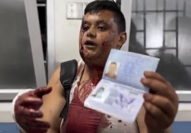 hayxtt's tweet photo. Palestinians holding up their passports from other nations, in an attempt to humanize themselves…bc being an American or British citizen is worth more in the eyes of the western world than being a Palestinian. https://t.co/IClZzyA6di