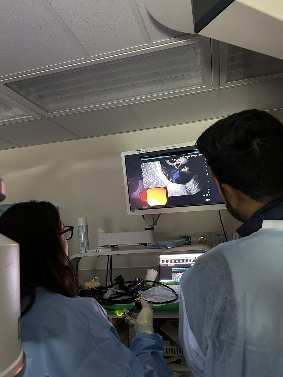 MSSN_Gastro's tweet photo. Successful #cholecystoduodenostomy by our amazing Interventional GI @AdvaniRashmiMD and Interventional Fellow @PranayS88 #GITwitter #Medtwitter #fellowship @MountSinaiNYC https://t.co/MQ4Xr0Geo8