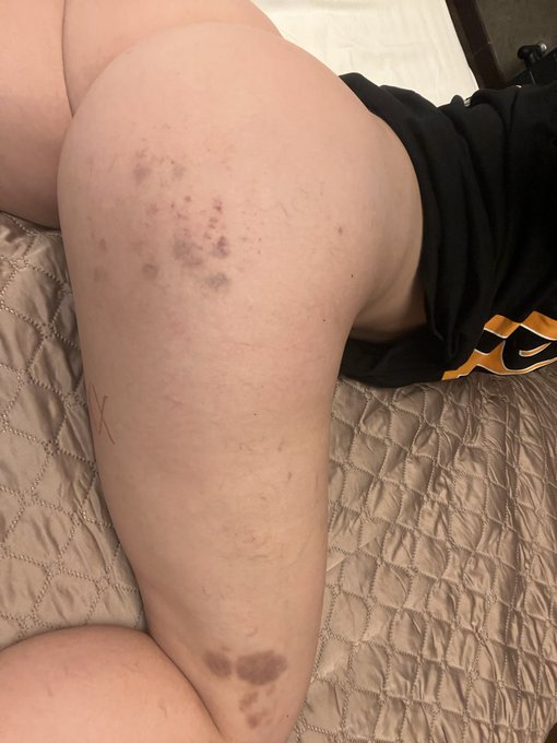 🙀🙈 https://t.co/ldnU2dEtqt<a href="/tag/xbizeuropas"class="tags"><span>#xbizeuropas</span></a>