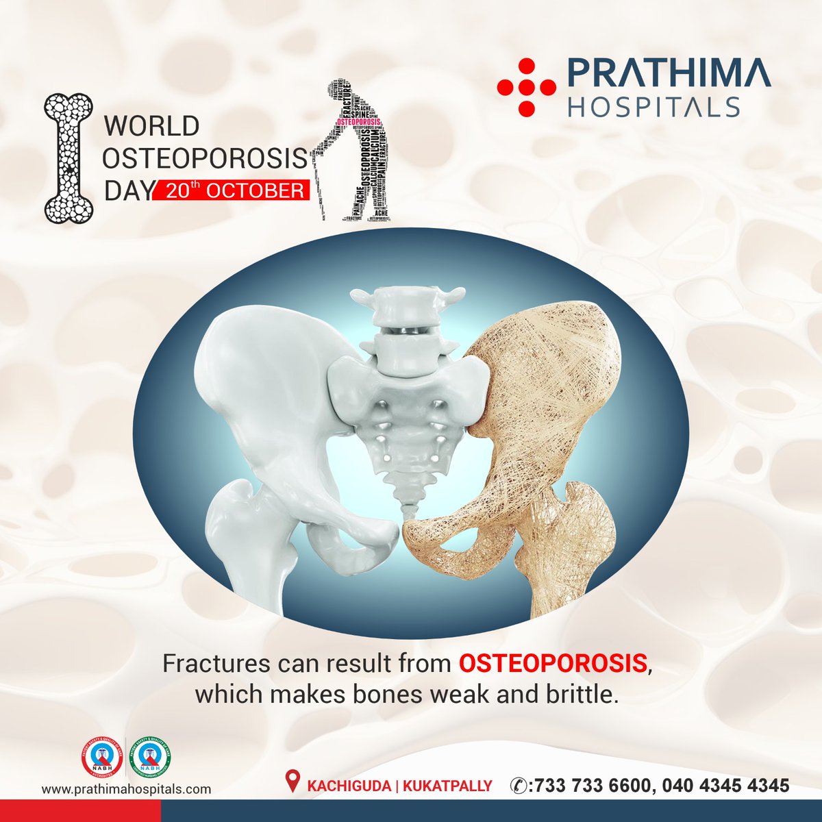 Fractures can result from OSTEOPOROSIS, which makes bones weak and brittle.

#OsteoporosisDay #BoneHealth #StrongBones #PreventOsteoporosis #HealthyAging #FracturePrevention #BonesMatter #CalciumIntake #OsteoporosisAwareness #prathimahospitals #ph