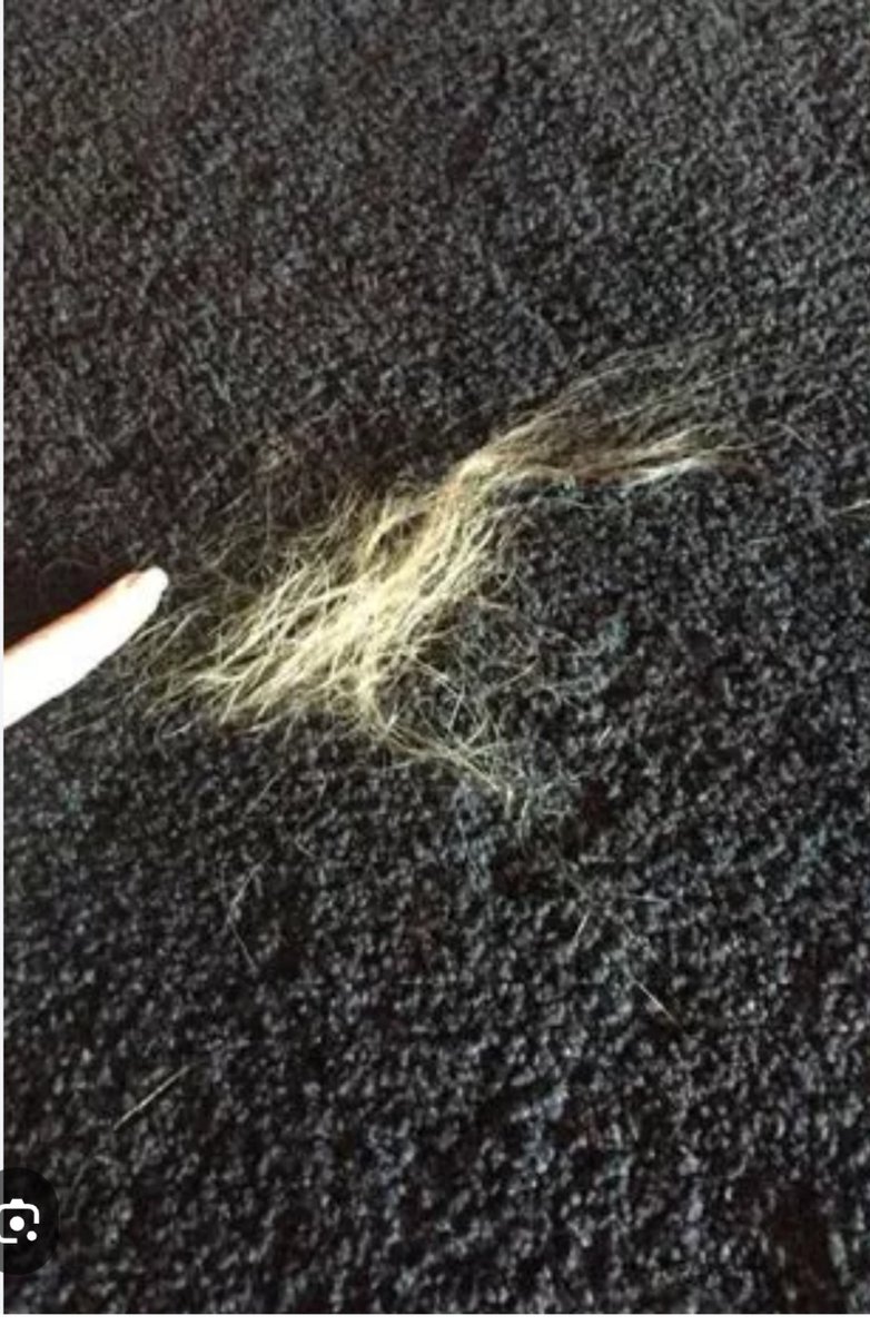 terri0928's tweet photo. #JohnnyDeppWon 

AH's clump of hair which she claims JD ripped out by the roots. Yet there are no roots attached to the clump of hair. Also, compared to the finger in the pic, the hair appears to be about 3-4 inches. Pic of AH's hair around the time of this so called incident. https://t.co/CWB1ZHxkTa