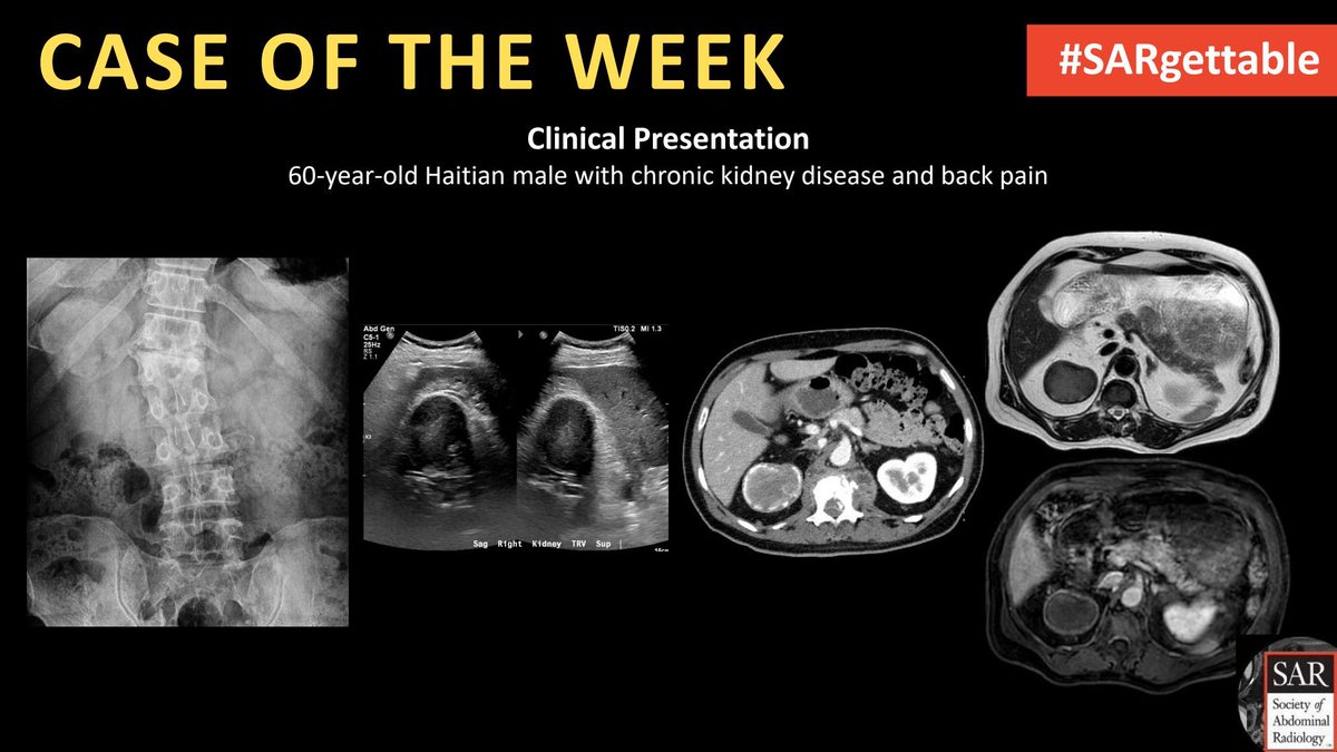 It's time for a new #SARgettable case of the week contributed by @kchang! Comment with your diagnosis down below!