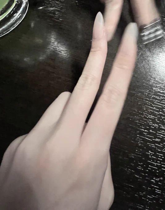 アタシ中指折れてんだよね
