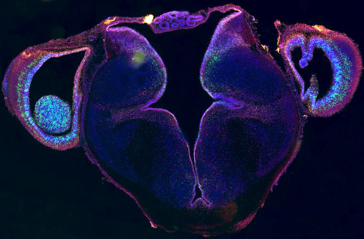 Sara Jiménez (@saraaj27) on Twitter photo My first results as a post-doctoral fellow in the <a href="/PhyloBrain/">Fernando García-Moreno</a> group 🐣 🦎... are quite colourful 🤩🌈 #Evodevo My first results as a post-doctoral fellow in the <a href="/PhyloBrain/">Fernando García-Moreno</a> group 🐣 🦎... are quite colourful 🤩🌈 #Evodevo