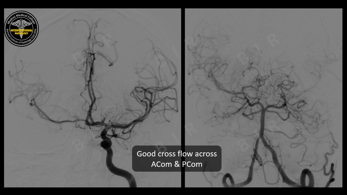 Interventional Radiology BIR, RGGGH@Chennai tweet media