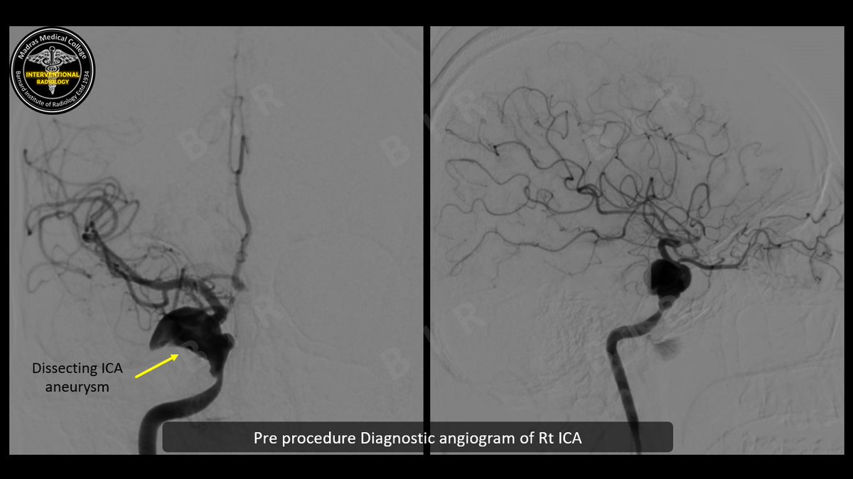 Interventional Radiology BIR, RGGGH@Chennai tweet media