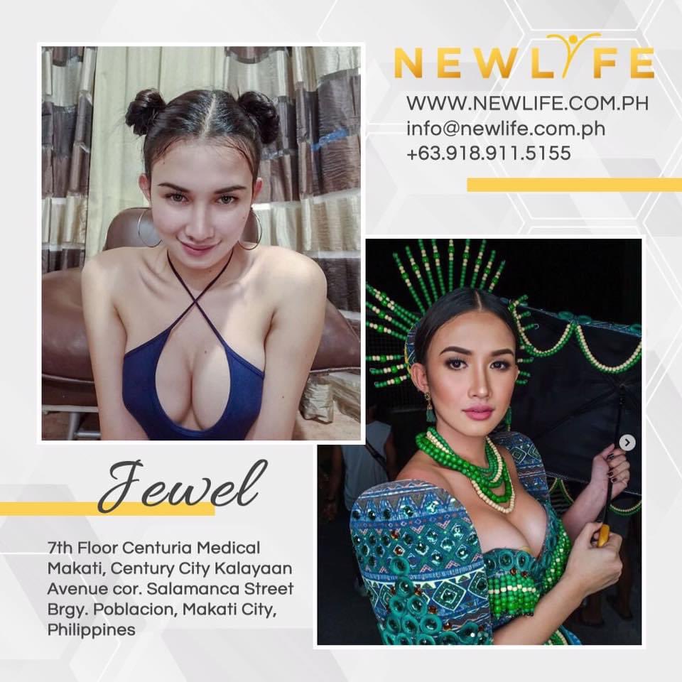 Money99Ai's tweet photo. BreastAugmentation Dr. James Joaquino; a board-certified #PlasticSurgeon with more than 30 years of experience, and whose expertise is most sought after by celebrities, models and beauty queens.
Advise 👨‍⚕️Dr. James Joaquino directly through Viber, WeChat or WhatsApp at 09189115155 https://t.co/AW5lOZqygS