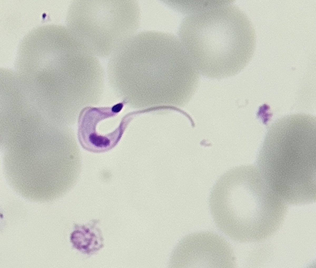 👀Live from the clinical lab: Trypanosoma cruzi trypomastigote in a thin blood film. Note the typical shape of the parasite with the large kinetoplast and the undulating membrane. #Thinkparasite #chagasdisease