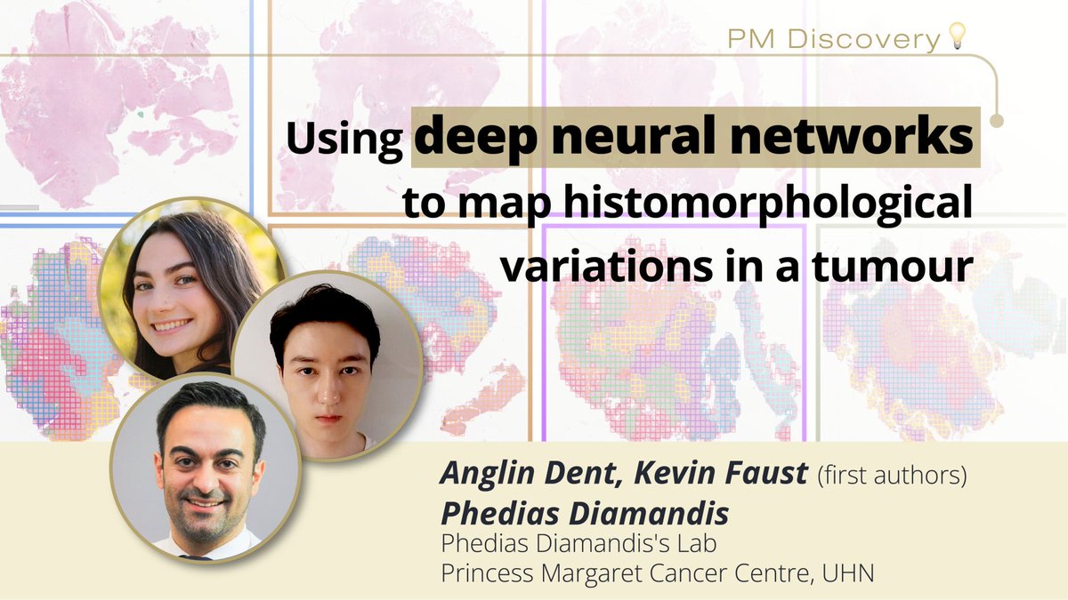 Princess Margaret Cancer Centre Research (@pmresearch_uhn) on Twitter photo Using AI to map tumour heterogeneity 🔬
Dr. Phedias Diamandis (<a href="/pdiamandisii/">Phedias Diamandis</a>) from <a href="/UHN/">University Health Network</a> has developed a tool called HAVOC that uses AI to help us understand the different shapes and structures within a tumour.
Read on <a href="/ScienceMagazine/">Science Magazine</a>: science.org/doi/10.1126/sc… Using AI to map tumour heterogeneity 🔬
Dr. Phedias Diamandis (<a href="/pdiamandisii/">Phedias Diamandis</a>) from <a href="/UHN/">University Health Network</a> has developed a tool called HAVOC that uses AI to help us understand the different shapes and structures within a tumour.
Read on <a href="/ScienceMagazine/">Science Magazine</a>: science.org/doi/10.1126/sc…