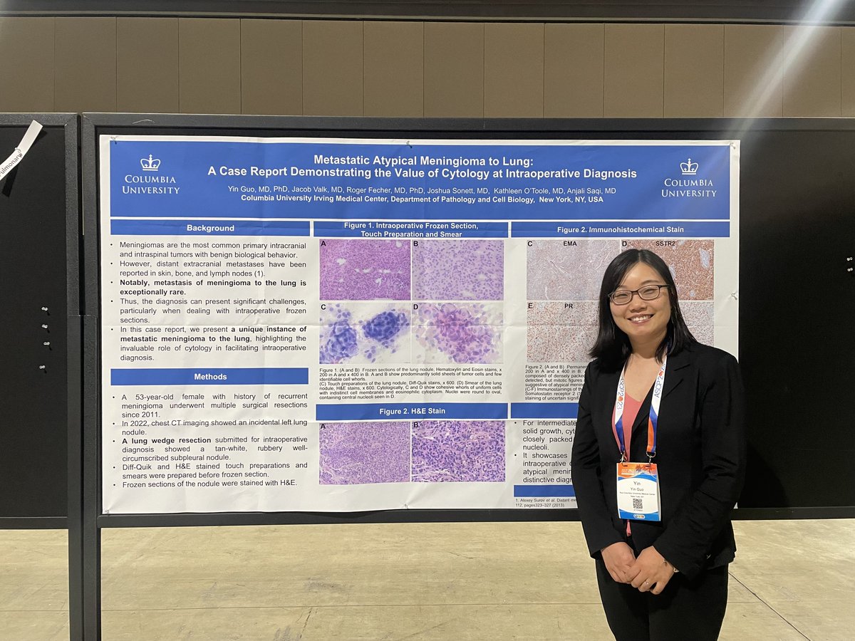 Congrats to our chief residents, Courtney and Yin, on their presentations at #ASCP2023 ! 🎉 Courtney's abstract was selected as a blue-ribbon finalist!