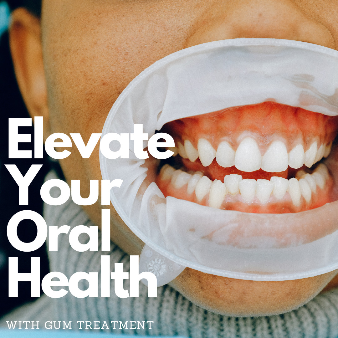 Ready to take the first step towards healthier, happier gums? Contact us today for a consultation, and let's rejuvenate your smile from the roots up! 🌿👩‍⚕️👨‍⚕️ 

#GumTreatment #OralWellness #GeorgeBureauDentistry #HealthySmilesStartHere