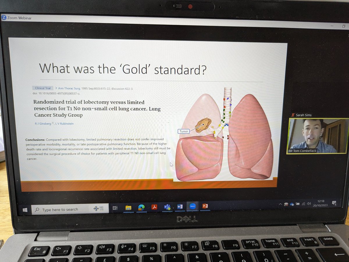FordPhysio's tweet photo. Dr Tom Combellak, consultant Thoracic Surgeon talking all about Lung Resection and Robotic Surgery. Can we improve patient outcomes providing it in Wales?! @WelshICS  #wicsupdate2023 https://t.co/05IxUcjK27