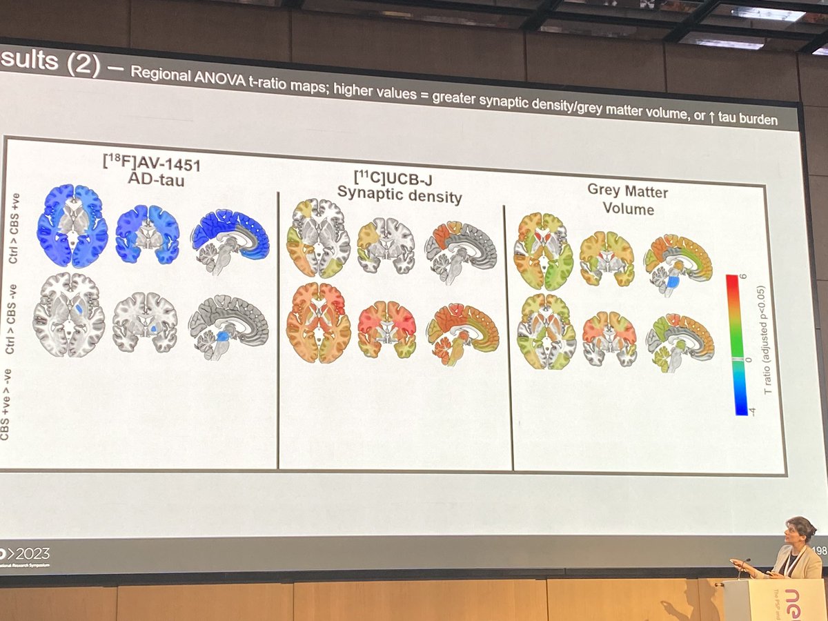 NeuroMetrology's tweet photo. Lovely talk by @HollandNegin and a great session. @CurePSP @PSPAssociation @KristopheDiaz #Neuro23 https://t.co/hdyAUxD8oo