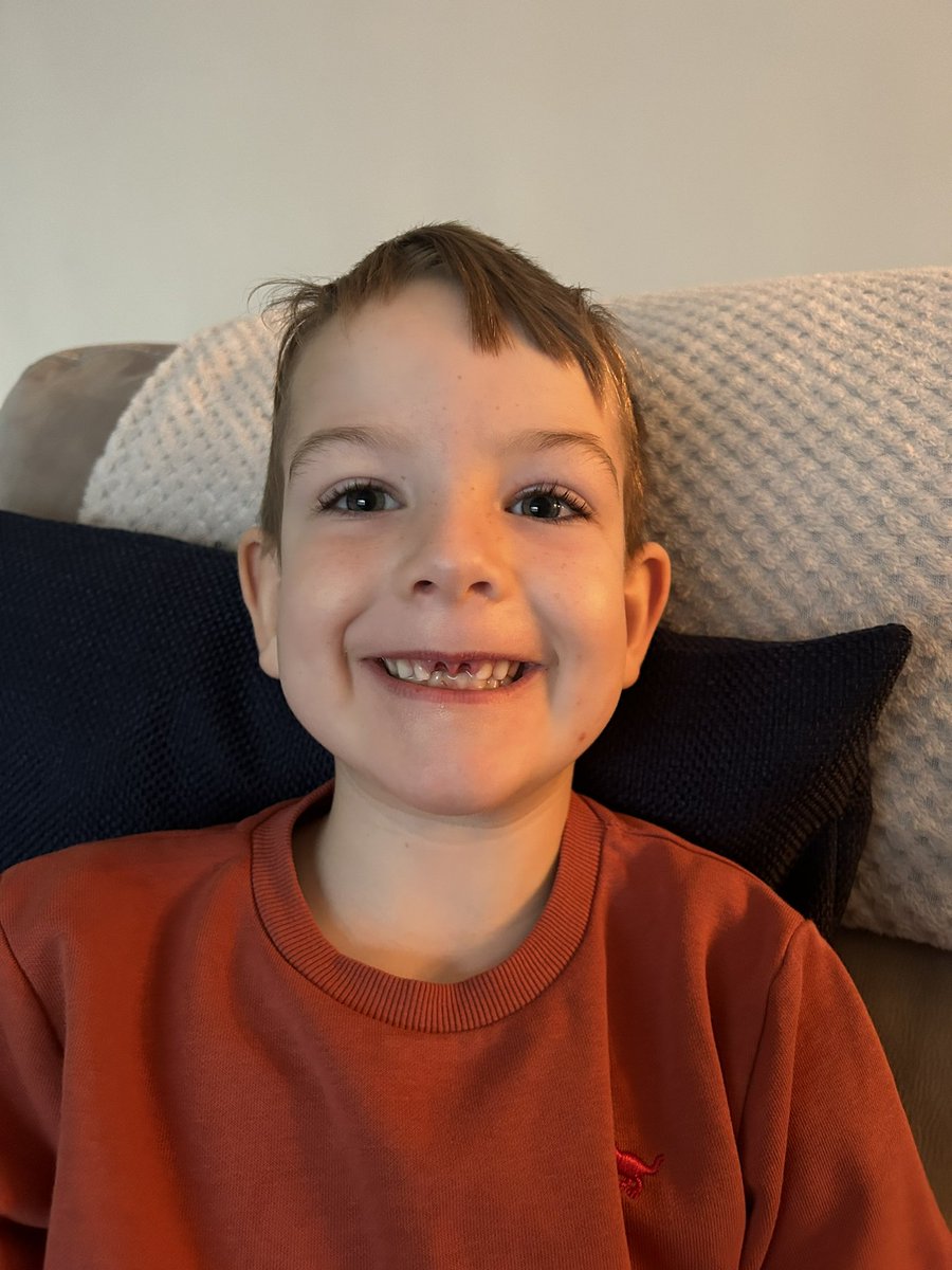 gem_hilton's tweet photo. Mason has been such a brave boy at the dentist this morning, having his two front teeth out 🦷😁🪥 @SouthfieldFS https://t.co/SbTND7Af9V