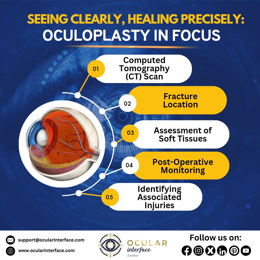 OcularInterface's tweet photo. "Seeing Clearly, Healing Precisely: Oculoplasty in Focus" 

Visit our Website ▶️ https://t.co/kxPo3fSKqr

#OcularInterface #Oculoplasty #OrbitalFractures #PrecisionHealing #EyeHealth #SurgicalPrecision https://t.co/JRVBMga4u8