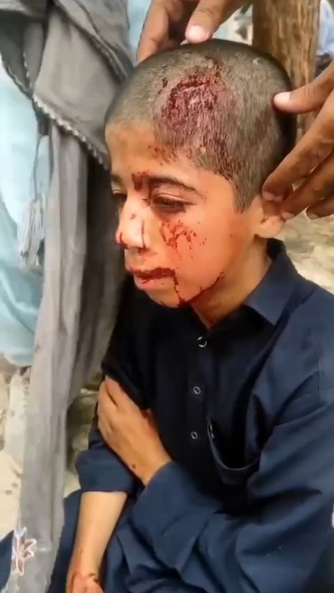 متاسفم پسرم ! متاسفم که تو کودک غزه نیستی تا ژورنالیست های بی وطن خودشونو شرحه شرحه کنن با تصویرت 💔 #بلوچستان
