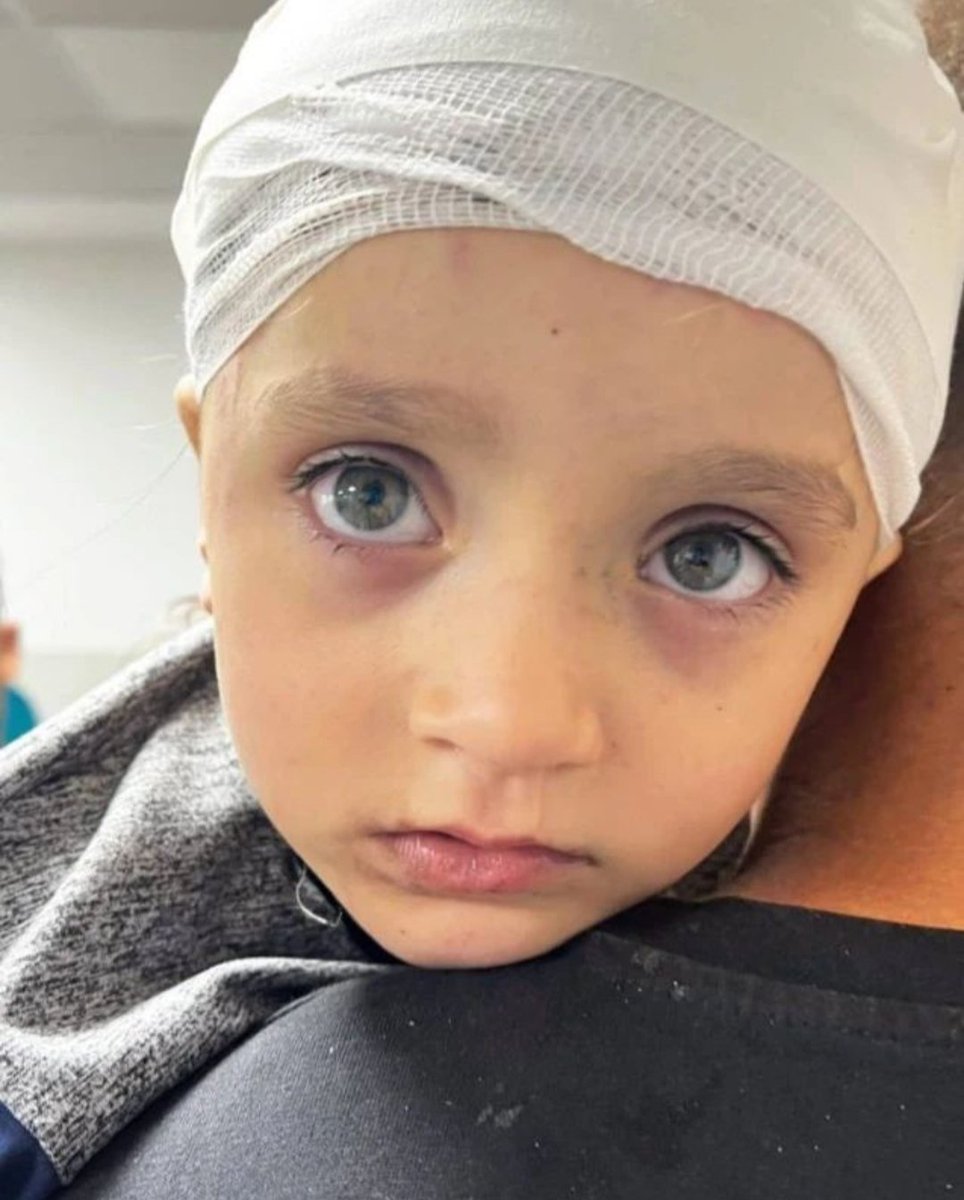 EsmaelNourUkba5's tweet photo. Его глаза просто спрашивают мир: ПОЧЕМУ?

#zionistterror #WarCrimes #guiltyofhumanity #UNICEF #amnestyinternational https://t.co/pwitJM52DA