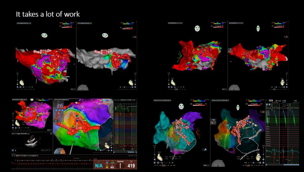Timothy Markman (@dr_markman) on Twitter photo #EPeeps <a href="/2023WSA/">World Arrhythmia Congress 2023</a> will include discussion of what we can/should do for complex AF substrates when we know that PVI will not be enough. Looking forward to this presentation along with a review of our newest approaches to #CNA <a href="/PennEPFellows/">Penn Electrophysiology Fellowship</a>. <a href="/MDTolgaAksu/">Tolga Aksu, MD</a> <a href="/jczerpa/">JC ZERPA</a> <a href="/StavrosStavrak1/">Stavros Stavrakis</a> #EPeeps <a href="/2023WSA/">World Arrhythmia Congress 2023</a> will include discussion of what we can/should do for complex AF substrates when we know that PVI will not be enough. Looking forward to this presentation along with a review of our newest approaches to #CNA <a href="/PennEPFellows/">Penn Electrophysiology Fellowship</a>. <a href="/MDTolgaAksu/">Tolga Aksu, MD</a> <a href="/jczerpa/">JC ZERPA</a> <a href="/StavrosStavrak1/">Stavros Stavrakis</a>
