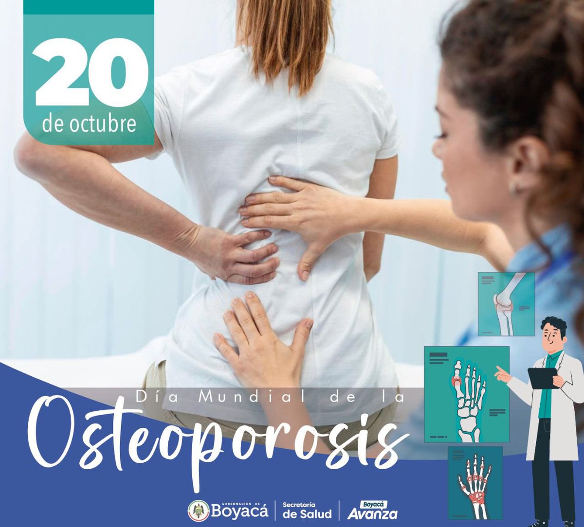 #Hoy en el Día Mundial de la Osteoporosis, recordemos la importancia de fortalecer nuestros huesos a través de una dieta balanceada, ejercicio regular y revisiones médicas periódicas. 

#DíaMundialdelaOsteoporosis #HuesosSaludables
#AsíBoyacáAvanza