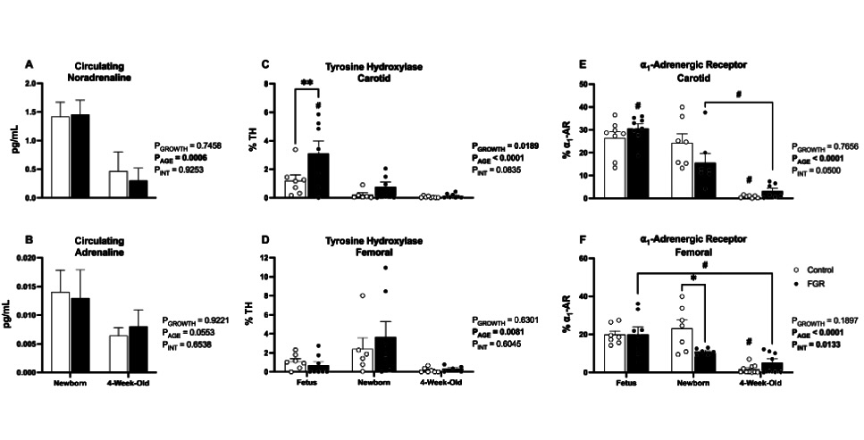 AJP-Heart and Circ (@ajpheartcirc) on Twitter photo #ArticlesInPress: Cardiovascular decline in offspring during the perinatal period in an ovine model of #fetal growth restriction
(Rock et al.)
ow.ly/G0no50PYZKs
<a href="/BethJForbes/">Beth Allison (she/her)</a> <a href="/Arvind_Monash/">ARVIND SEHGAL Prof of Pediatrics Monash University</a> <a href="/CharmaineRRock/">Charmaine Rock</a> <a href="/TeganWhite_/">Tegan White</a>
<a href="/Hudson_Research/">Hudson Institute of Medical Research</a>
#FetalGrowthRestriction #Fetus #ArticlesInPress: Cardiovascular decline in offspring during the perinatal period in an ovine model of #fetal growth restriction
(Rock et al.)
ow.ly/G0no50PYZKs
<a href="/BethJForbes/">Beth Allison (she/her)</a> <a href="/Arvind_Monash/">ARVIND SEHGAL Prof of Pediatrics Monash University</a> <a href="/CharmaineRRock/">Charmaine Rock</a> <a href="/TeganWhite_/">Tegan White</a>
<a href="/Hudson_Research/">Hudson Institute of Medical Research</a>
#FetalGrowthRestriction #Fetus