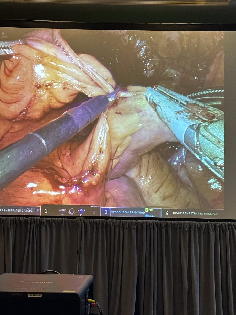 Tracey L. Krupski tweet media