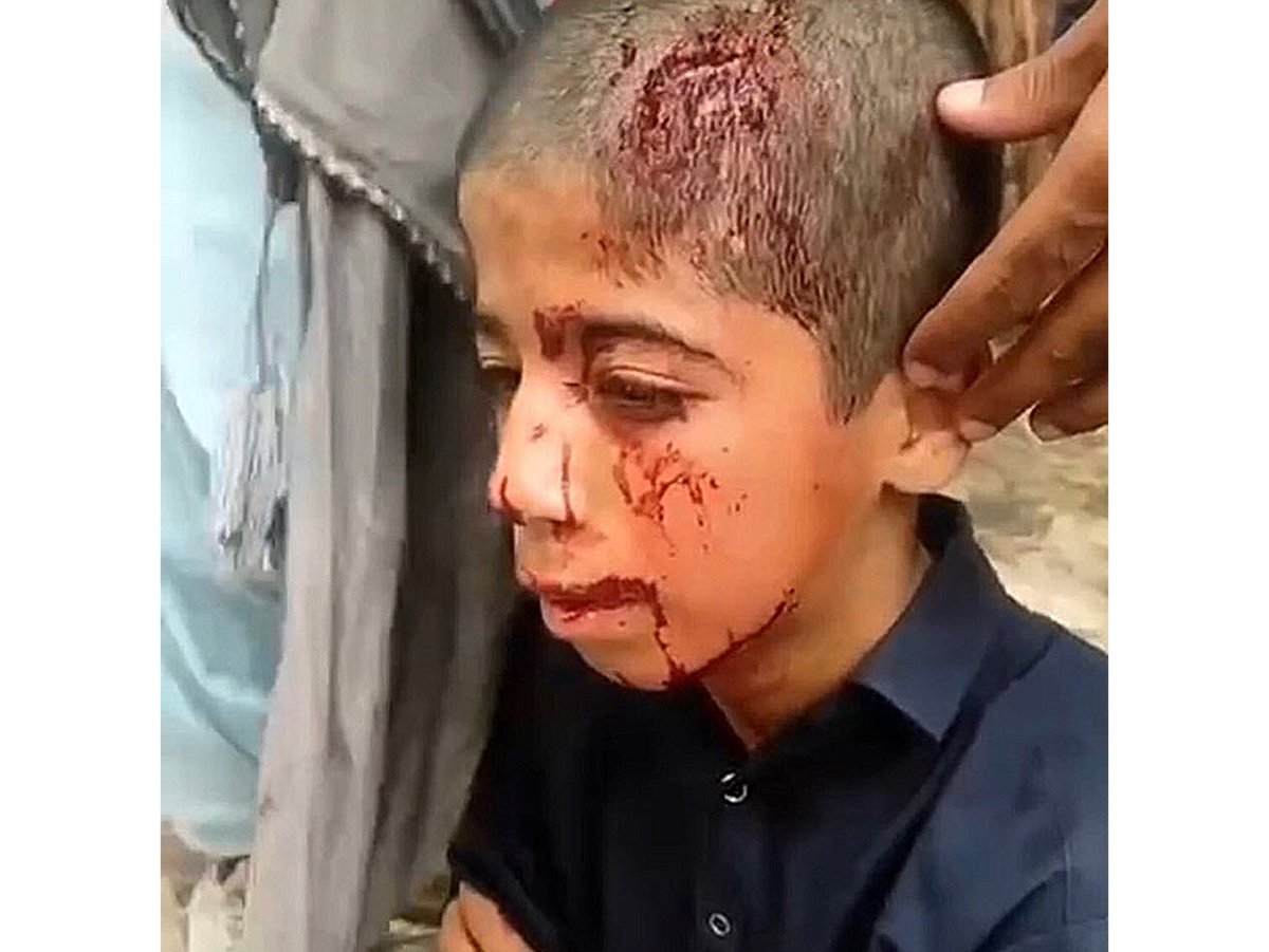 این تصویر امروز یک کودک در زاهدان است، حتی حیوانات به توله‌های همدیگر رحم می‌کنند، چهره واقعی جنایت همین است اگر کسی چشم دیدن دارد.
#زاهدان