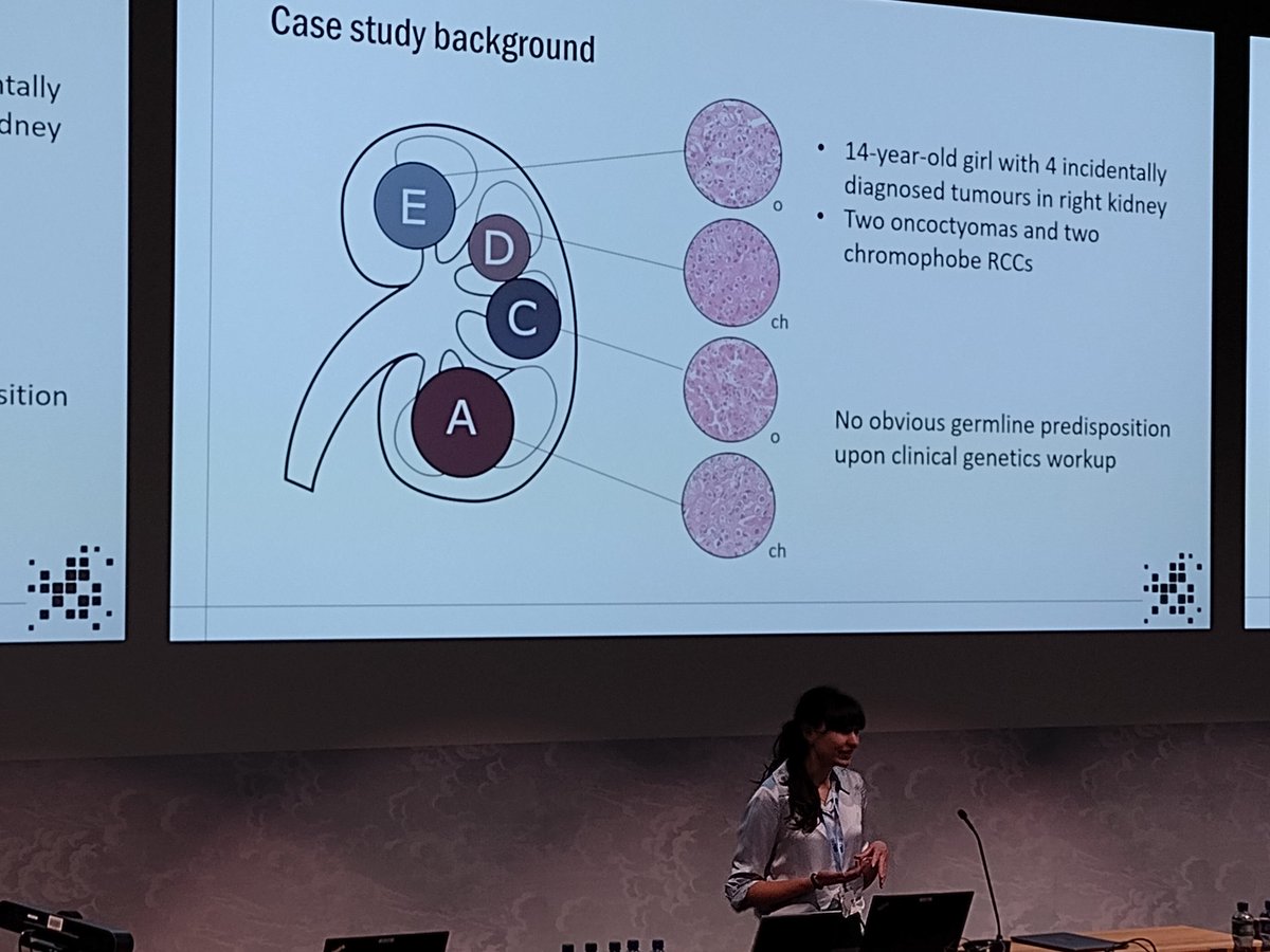 Tom Mitchell (@tom_j_mitchell) on Twitter photo Fantastic presentation by <a href="/ChloePacyna/">Chloe Pacyna</a> at #ESUR23 on rare renal tumors driven by a mosaic MTOR mutation. Fantastic presentation by <a href="/ChloePacyna/">Chloe Pacyna</a> at #ESUR23 on rare renal tumors driven by a mosaic MTOR mutation.