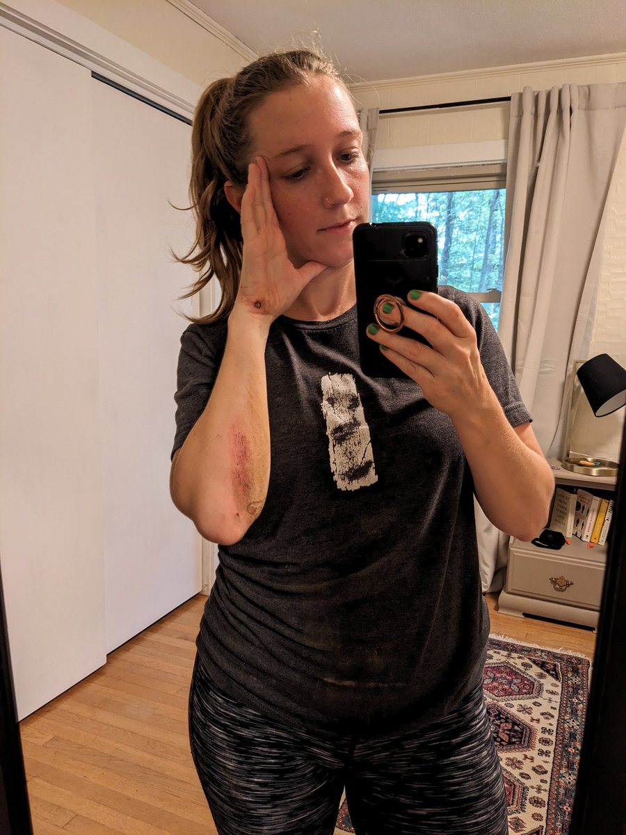 ElyseKeefe's tweet photo. At the risk of outing myself as a lil clumsy, here's more "anecdotal" evidence for why we need a greenway in Carrboro (especially as leaves fall, covering roots and rocks). Very much not my first fall out there. https://t.co/IyDPScOVfN