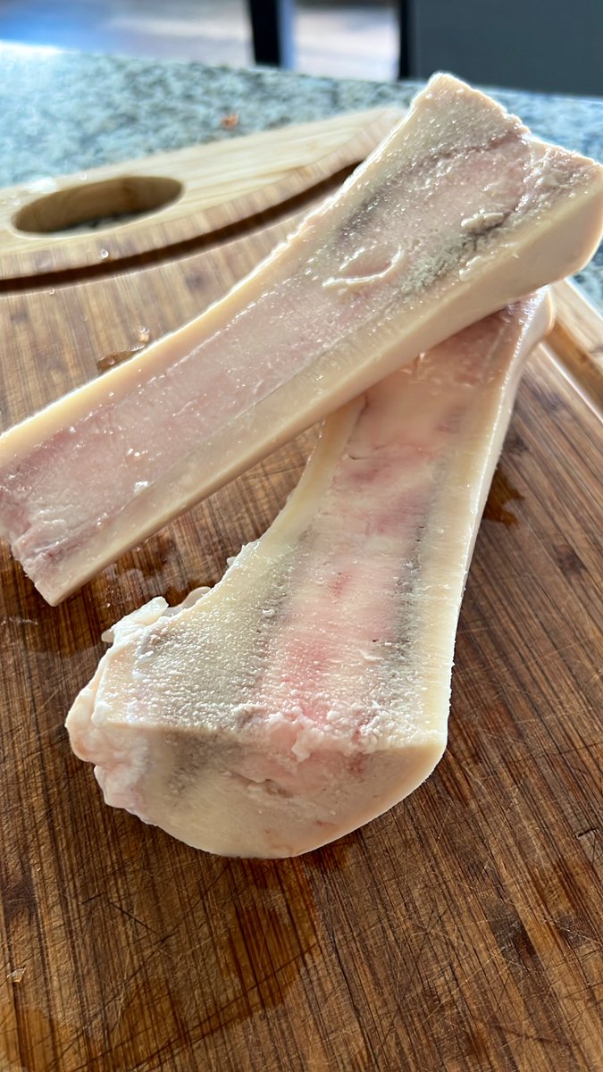 c_barn8's tweet photo. Is it just the red meat giving us diabetes or are bones off the table too?
#ShitScience #ShitResearch #Carnivore #MeatEater #BoneMarrow https://t.co/OVPBuomlSW