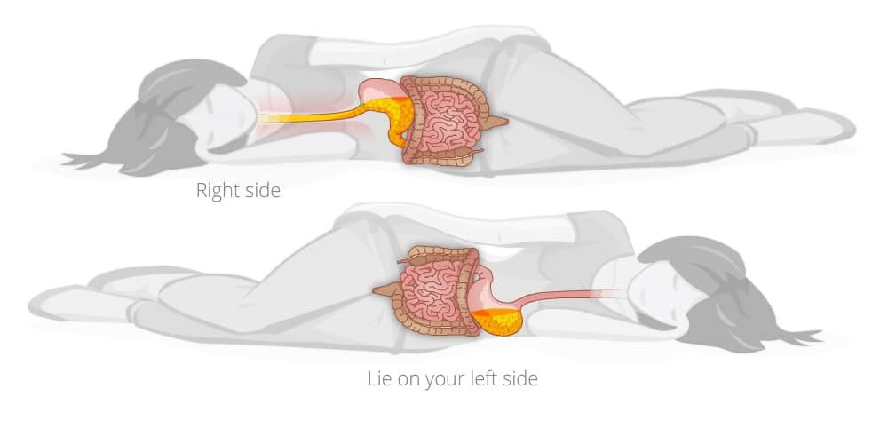 FirstDoctor's tweet image. If you have heartburns, normalize sleeping on your left side regularly. This can be as effective as taking an antacid medication. Repost: for others.