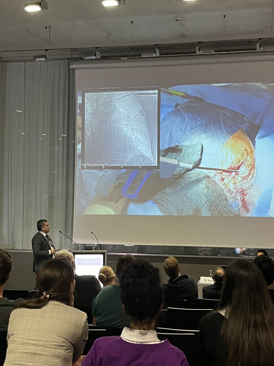 FSchindhelmMD's tweet photo. #MuhammedKurt mit einem spannenden Live-in-the-Box-Case über eine Schrittmacher-Explantation bei Device-Endokarditis #EssenFeelsTheBeat
@EssenBeat @TRassafMD @SMathewi @realdocdan @UniklinikEssen @unidue @DGK_org @YoungDgk @AGEP_DGK https://t.co/3csQw51qcP