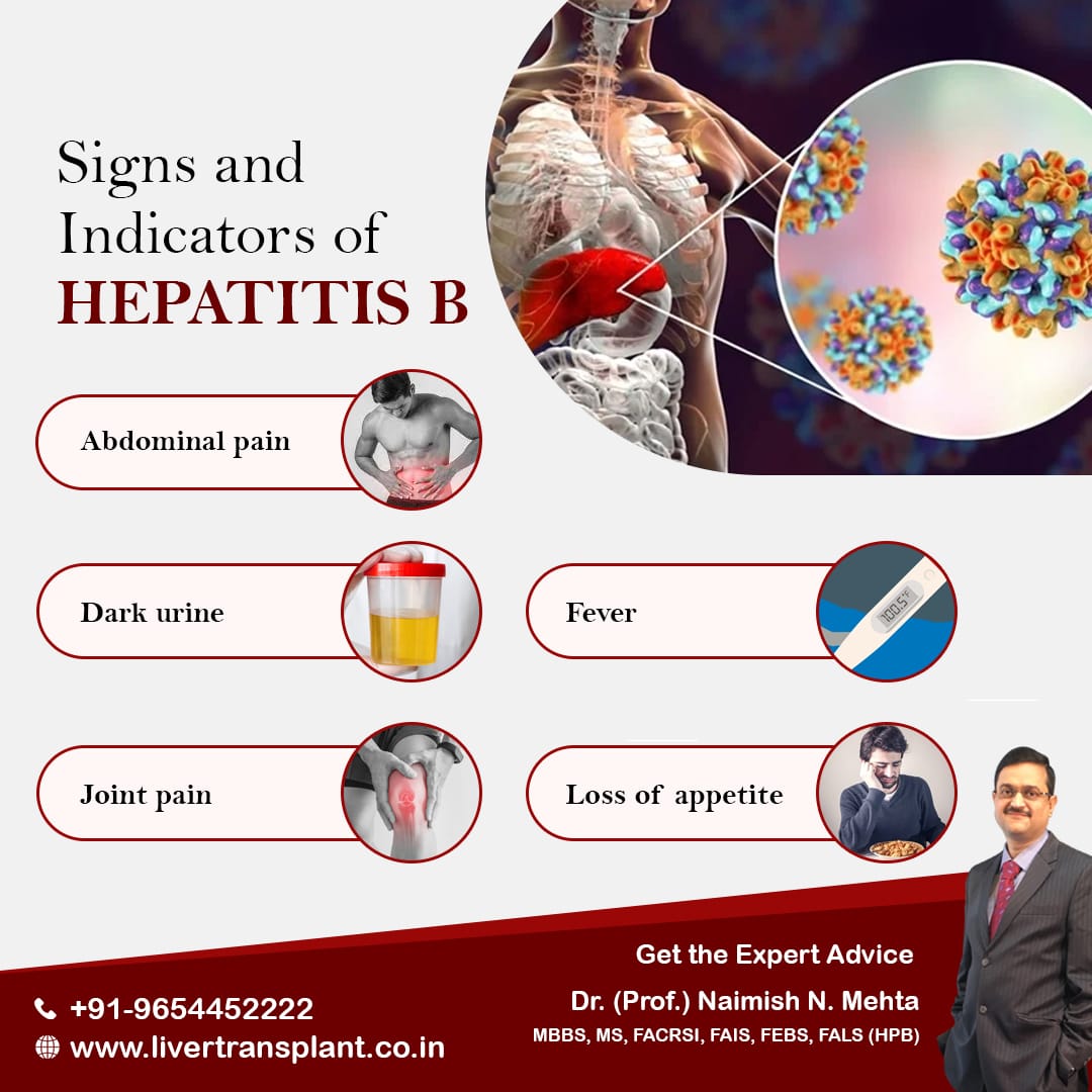 mehta_naimish's tweet image. Signs and Indicators of an Hepatitis B:
- Abdominal pain
- Dark urine
- Fever
- Joint pain
- Loss of appetite
- Nausea and vomiting

#hepatitis #LiverProblem #LiverSpecialist #hepatitisB #DrNaimishMehta