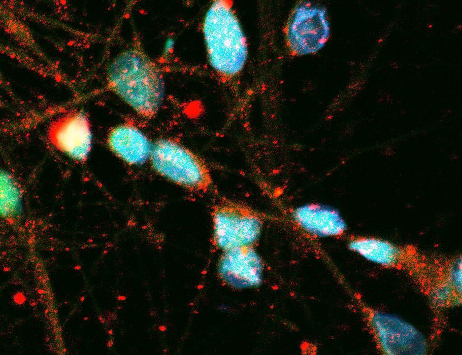High levels of long double-stranded RNA (#dsRNA) in neurons could protect the cells from viruses but might also lead to #neurodegenerative #inflammation. @ColumbiaMed 📄: scim.ag/4wG