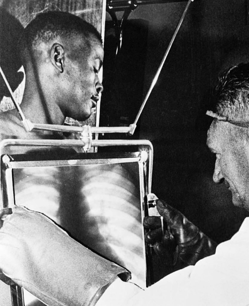 South African mine workers were x-rayed by radiologists at the end of each shift before leaving the De Beers diamond mines in Kimberley, South Africa, 1954. This was done to prevent even the smallest of diamonds from being smuggled out of the mine via the stomach.

Diamonds were