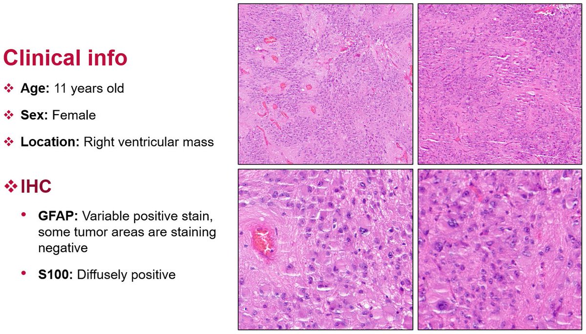 Kenneth Aldape, MD tweet media