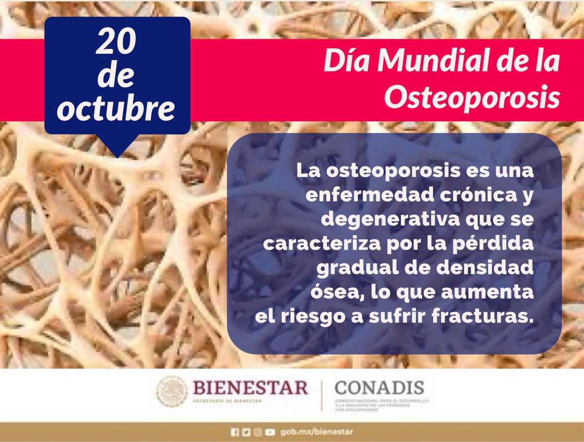 En el #DíaMundialDeLaOsteoporosis recordemos que la salud ósea es fundamental para una vida plena. Hagamos conciencia sobre la importancia de mantener nuestros huesos fuertes y saludables. gob.mx/conadis/articu…