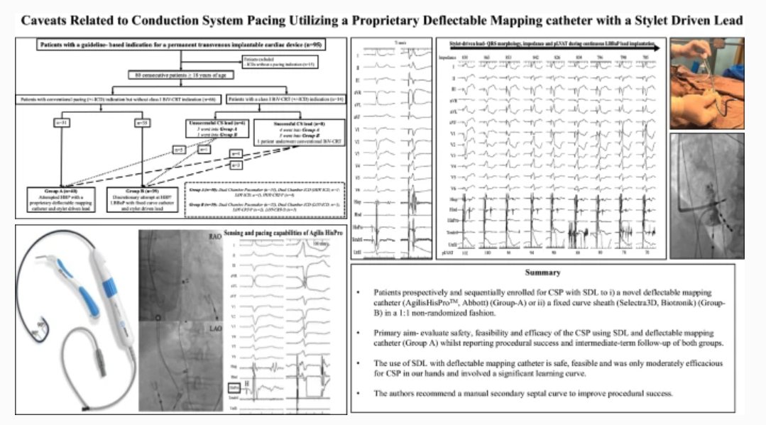 JICE (@jice_ep) on Twitter photo 🚨Latest #FreeRead Article in
<a href="/JICE_EP/">JICE</a>
Caveats Related to Conduction System Pacing Utilizing a Proprietary Deflectable Mapping Catheter with a Stylet-Driven Lead
by <a href="/anindya_0211/">Anindya Ghosh</a> <a href="/epakram_/">Mohamed Akram K A</a> CS Sriram & <a href="/UlhasDr/">Dr Ulhas Pandurangi</a>
🧐📖rdcu.be/do6Fx
#EPeeps 🚨Latest #FreeRead Article in
<a href="/JICE_EP/">JICE</a>
Caveats Related to Conduction System Pacing Utilizing a Proprietary Deflectable Mapping Catheter with a Stylet-Driven Lead
by <a href="/anindya_0211/">Anindya Ghosh</a> <a href="/epakram_/">Mohamed Akram K A</a> CS Sriram & <a href="/UlhasDr/">Dr Ulhas Pandurangi</a>
🧐📖rdcu.be/do6Fx
#EPeeps