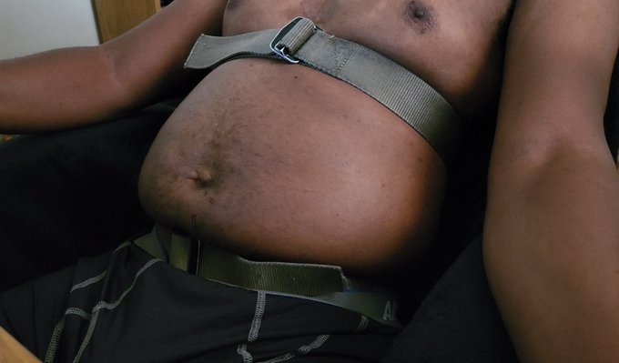 Just a small double belted inflation. Something I haven't done in a long while https://t.co/3WLLm1tA