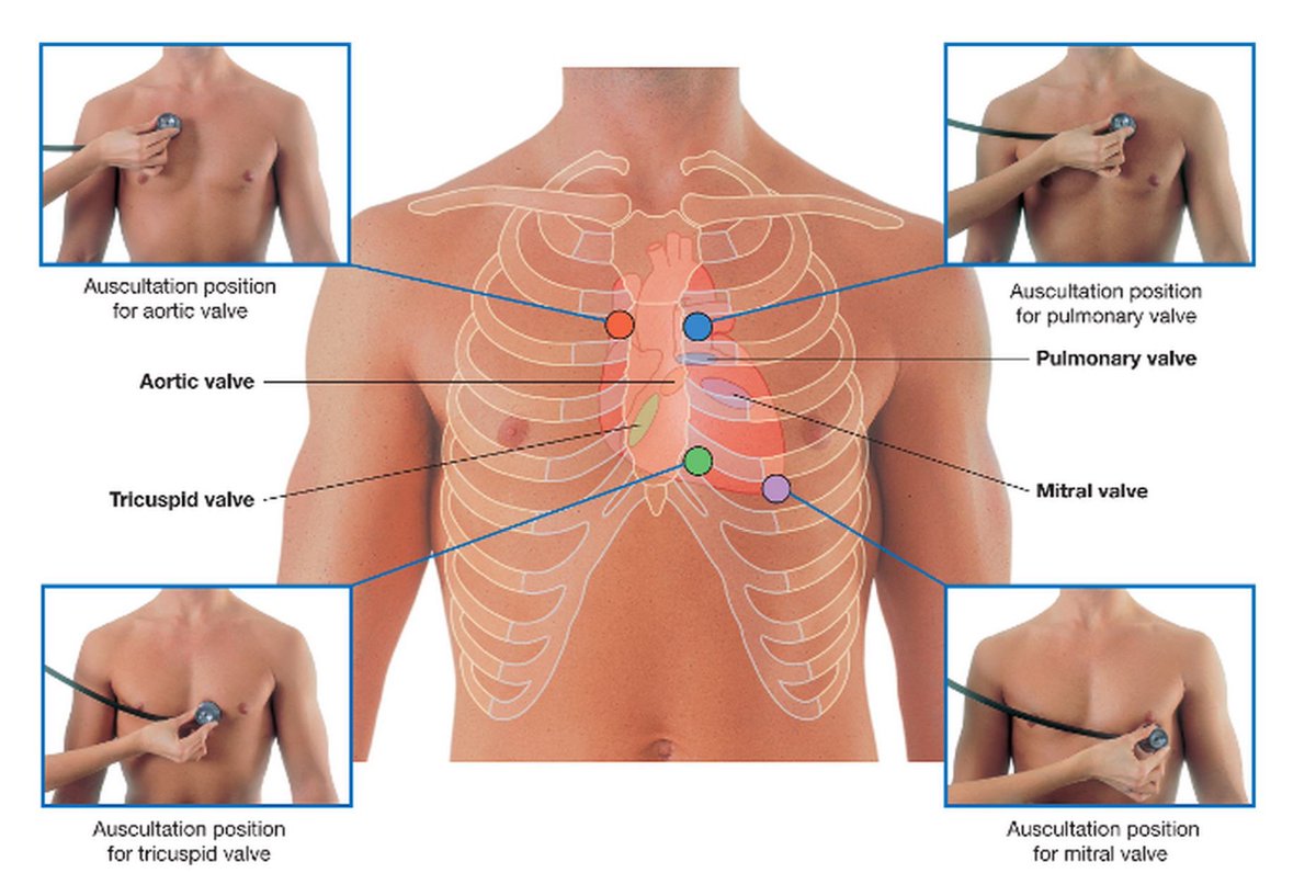 medictests's tweet image. Auscultation of the heart for visual learners!