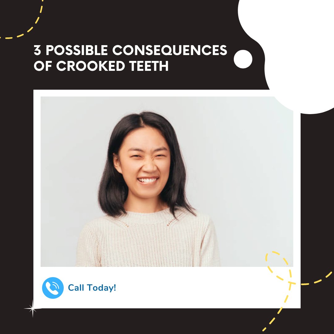 3 Possible Consequences of Crooked Teeth
• Cavities
• Gum disease
• Chipping or Breakage of Teeth