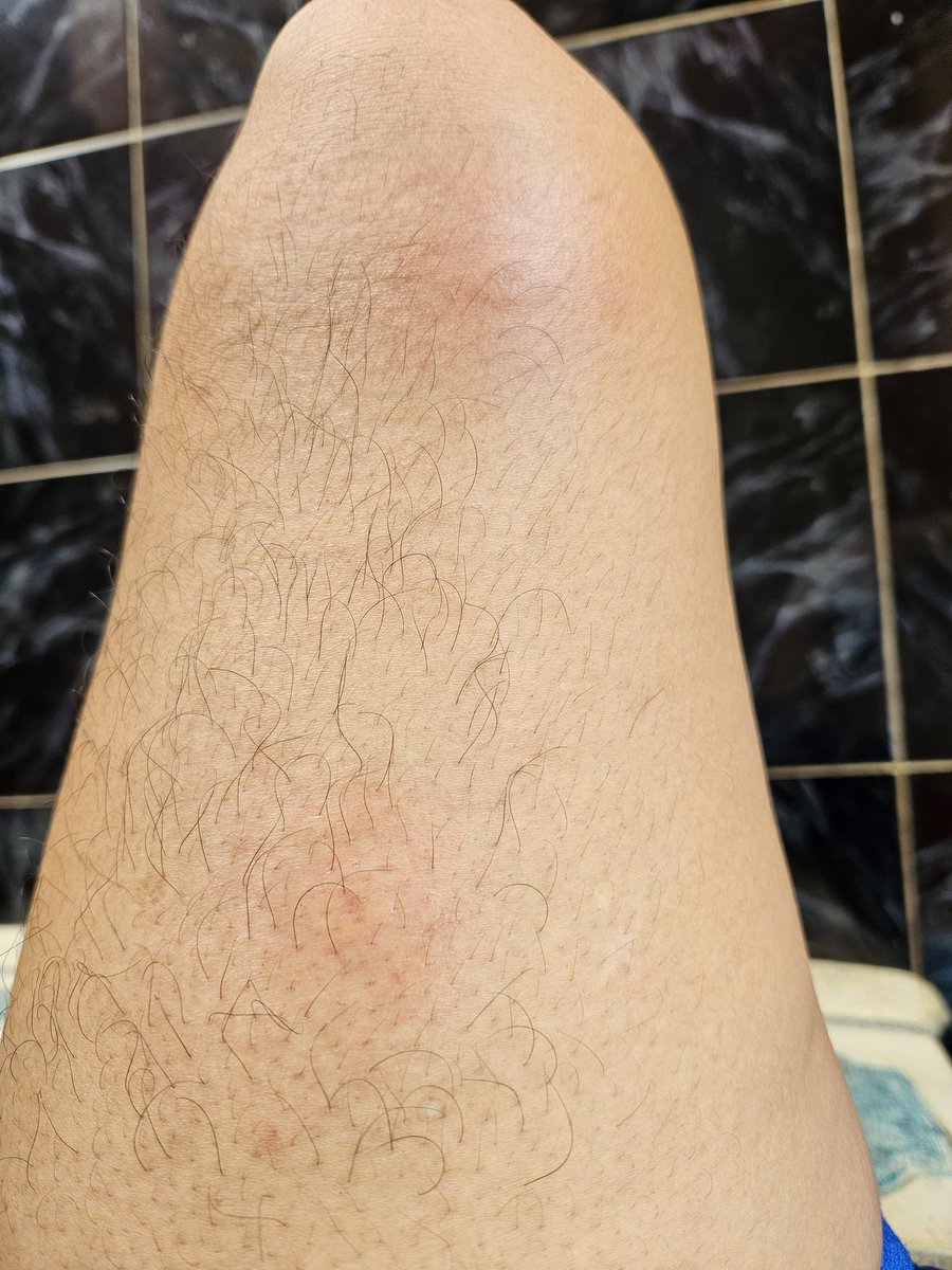 getthebit's tweet image. senut2 nyoyyyy ..kentup tawonn ndas patang nggon😵‍💫