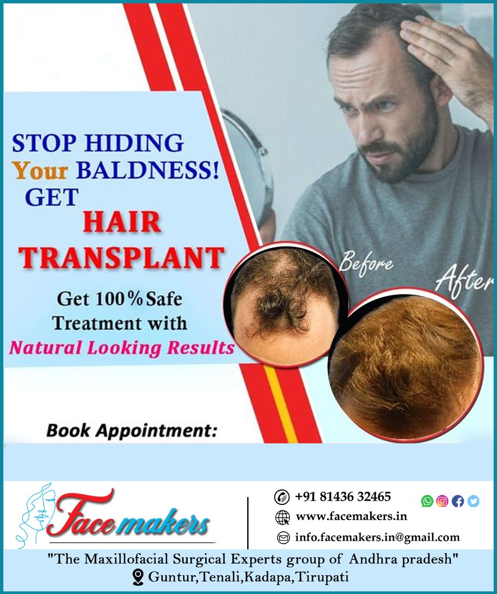 Stop Hiding Your Baldness Get Hair Transplant
For appointment :+ 91 81436 32465
#hairtranplantservices #naturallookingresults #Baldness
#bestmaxillofacialsurgeon #facemakerservices #naturalhairtreatment #100%results #hairsurgery #Baldness
#maxillofacialsurgeons