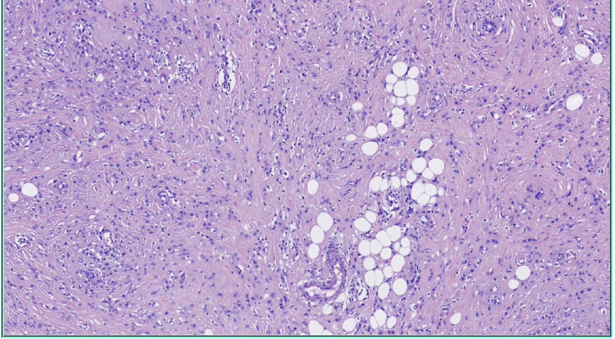 DrHou_pathology tweet picture