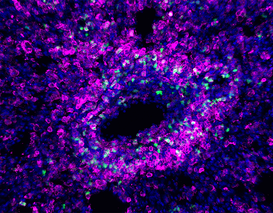 The CCR2 chemokine receptor helps recruit essential “backup” to lung dendritic cells mounting lungs’ immune response against #influenza, according to a 2021 study in mice: scim.ag/4x1 #WeekendReads