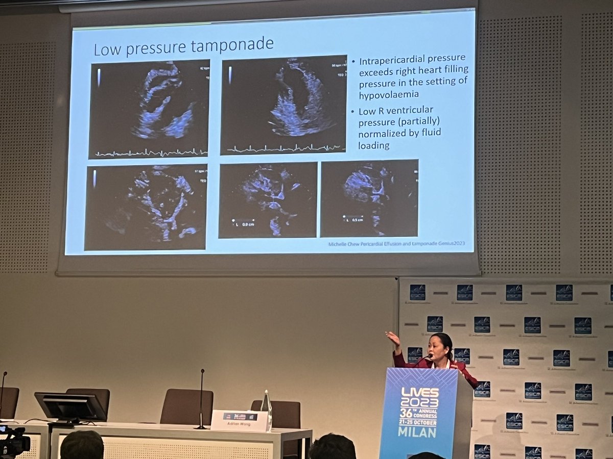 LauretaPereta's tweet photo. Now Michelle Cew presenting a challenging case of low pressure tamponade at #GENIUS course #LIVES23
#POCUS https://t.co/eVloqPBz8J