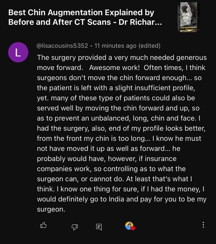 An encouraging comment on YouTube today #facesurgeon #maxfax #nosejob #chinsurgery #faces